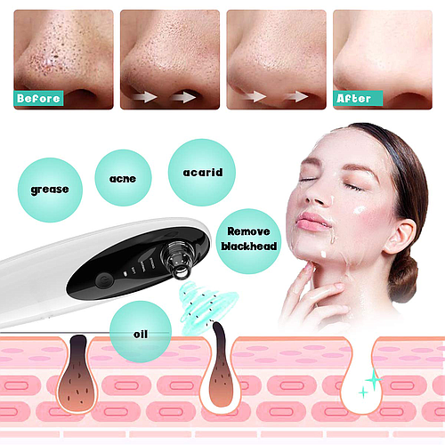 Costaline Blackhead Remover With Camera